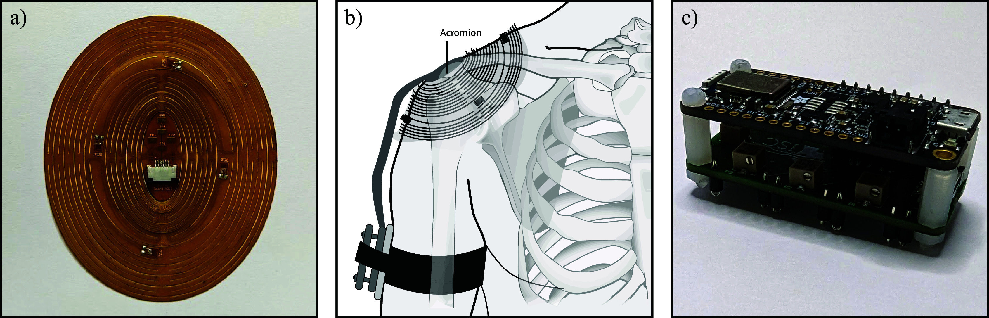 A kirigami-based shoulder patch: the flexible strain-gauge patch, its placement over the shoulder near the acromion, and the companion armband electronics.